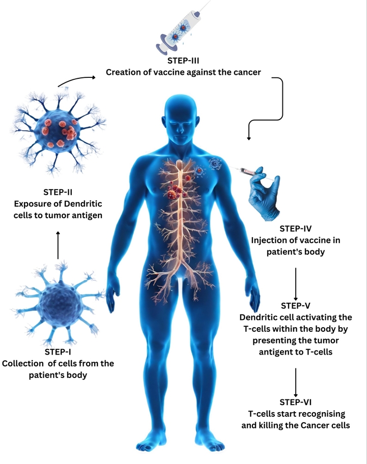 Dendritic Cell Therapy (DCT) - Cancer Treatment with Dendritic Cell-based Vaccine | Centre of Advanced Medicine, Frankfurt, Germany