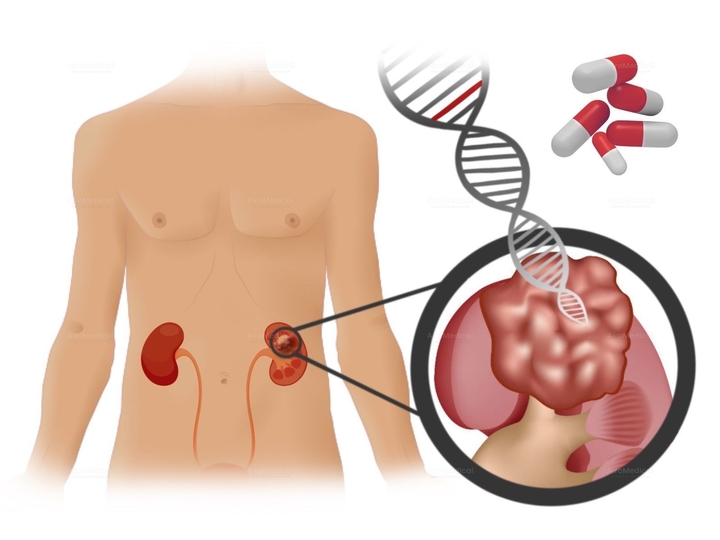 Pediatric Allogeneic Bone Marrow Transplantation at Motol University Hospital, Prague, Czechia