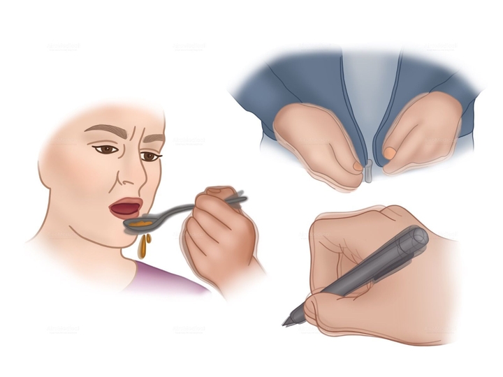 Basic Primary Epilepsy Diagnosis Program at Beta Clinic Bonn