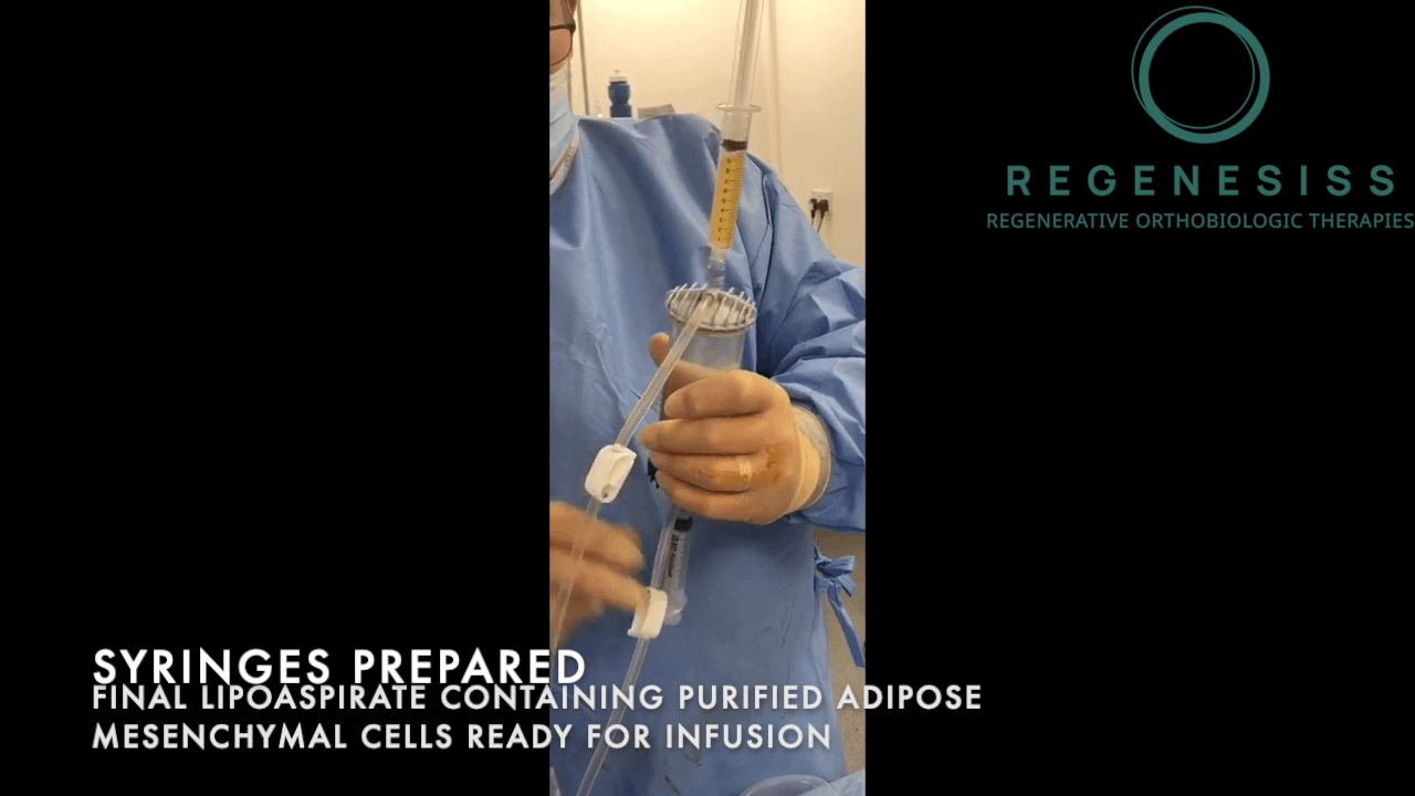 Lipogems REGENESISS
