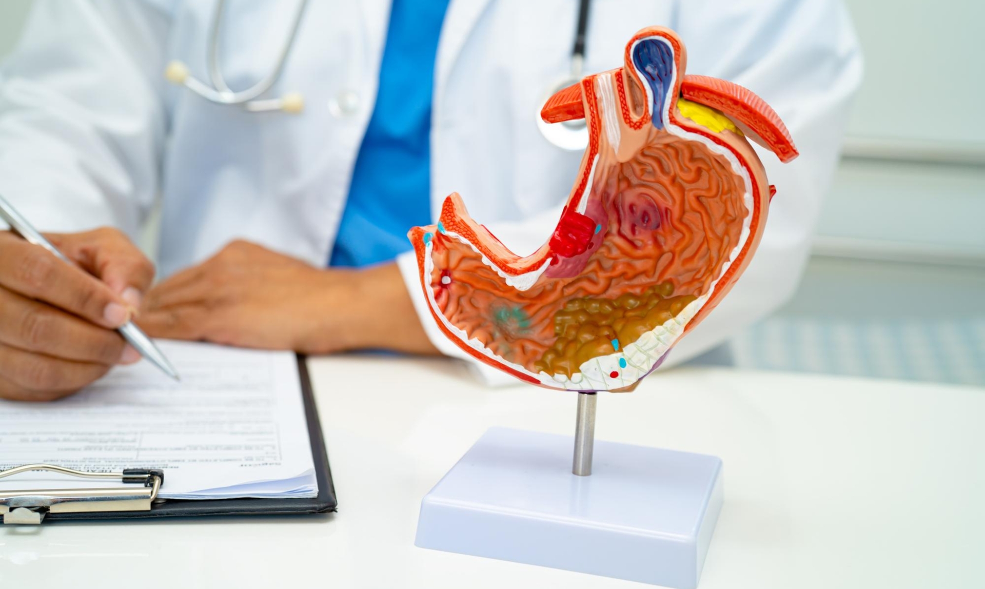 RefluxStop Surgery for Acid Reflux (GERD) in Europe image