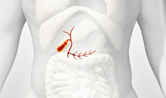 Bile Duct Cancer: About the Disease, Clinics and Treatments Options image